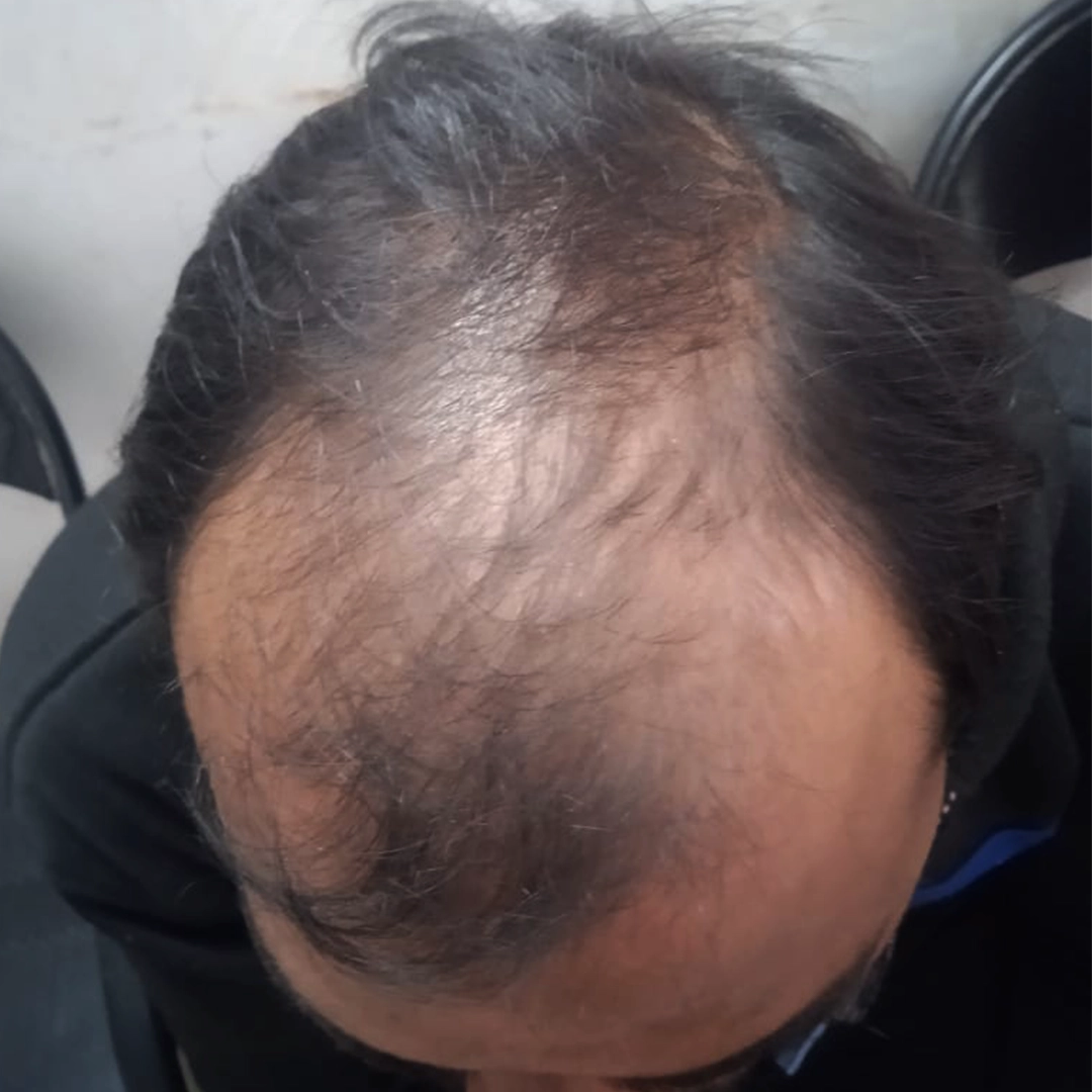 Before Image