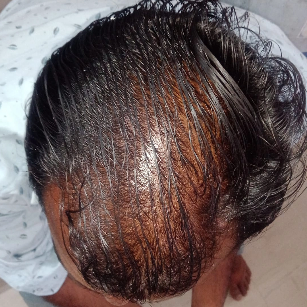After Image
