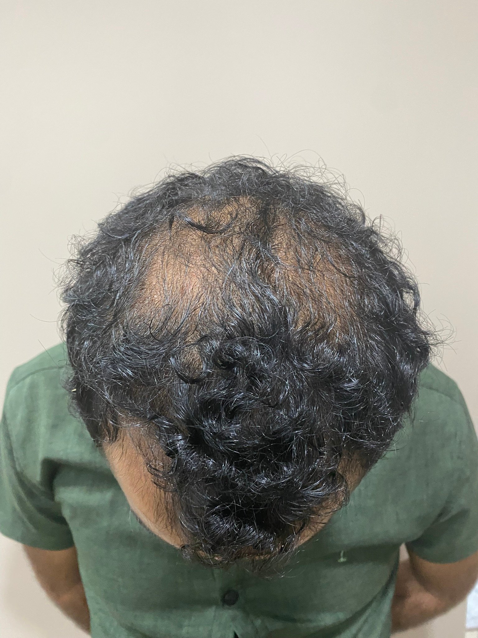 Before Image