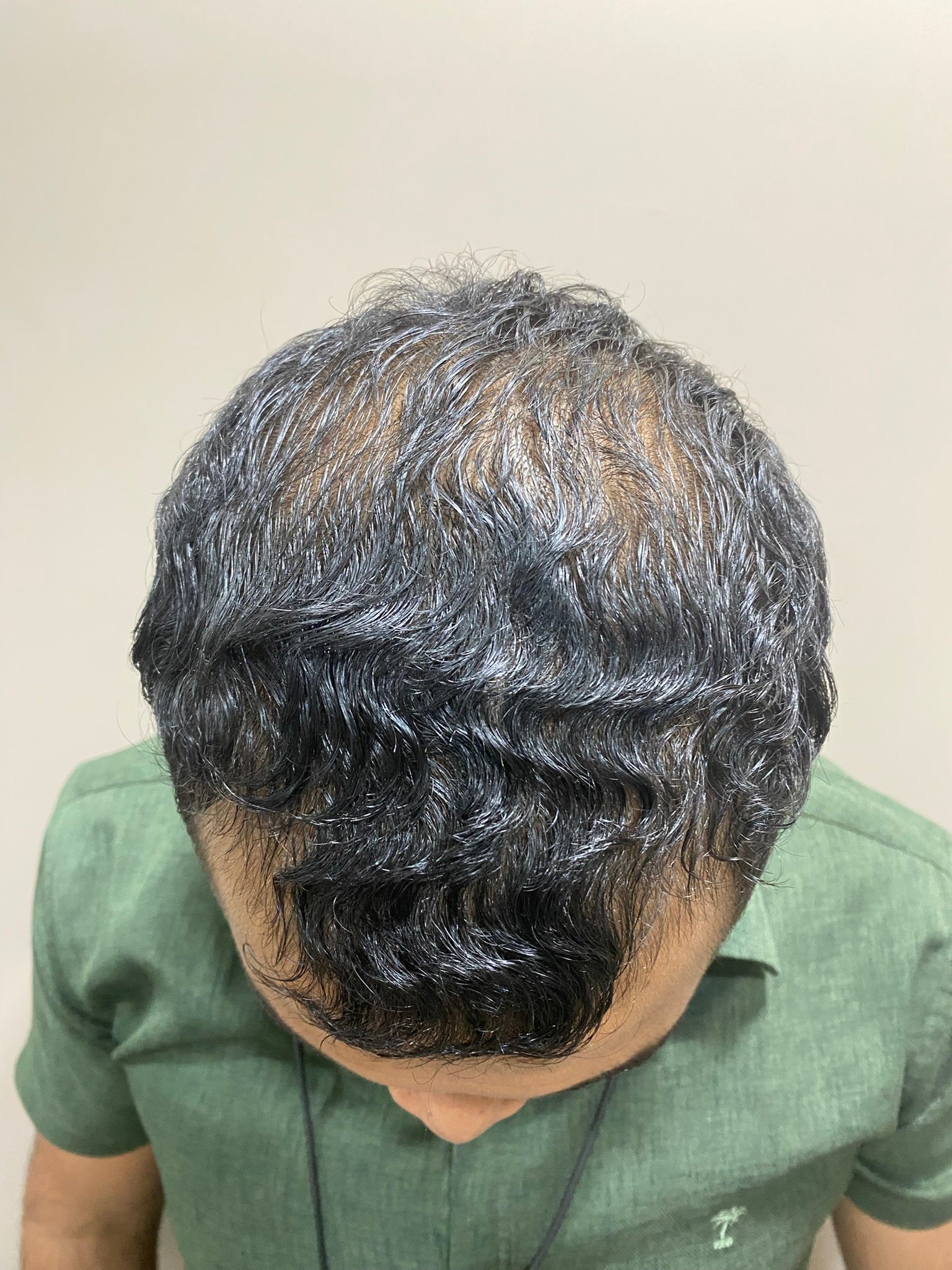 After Image