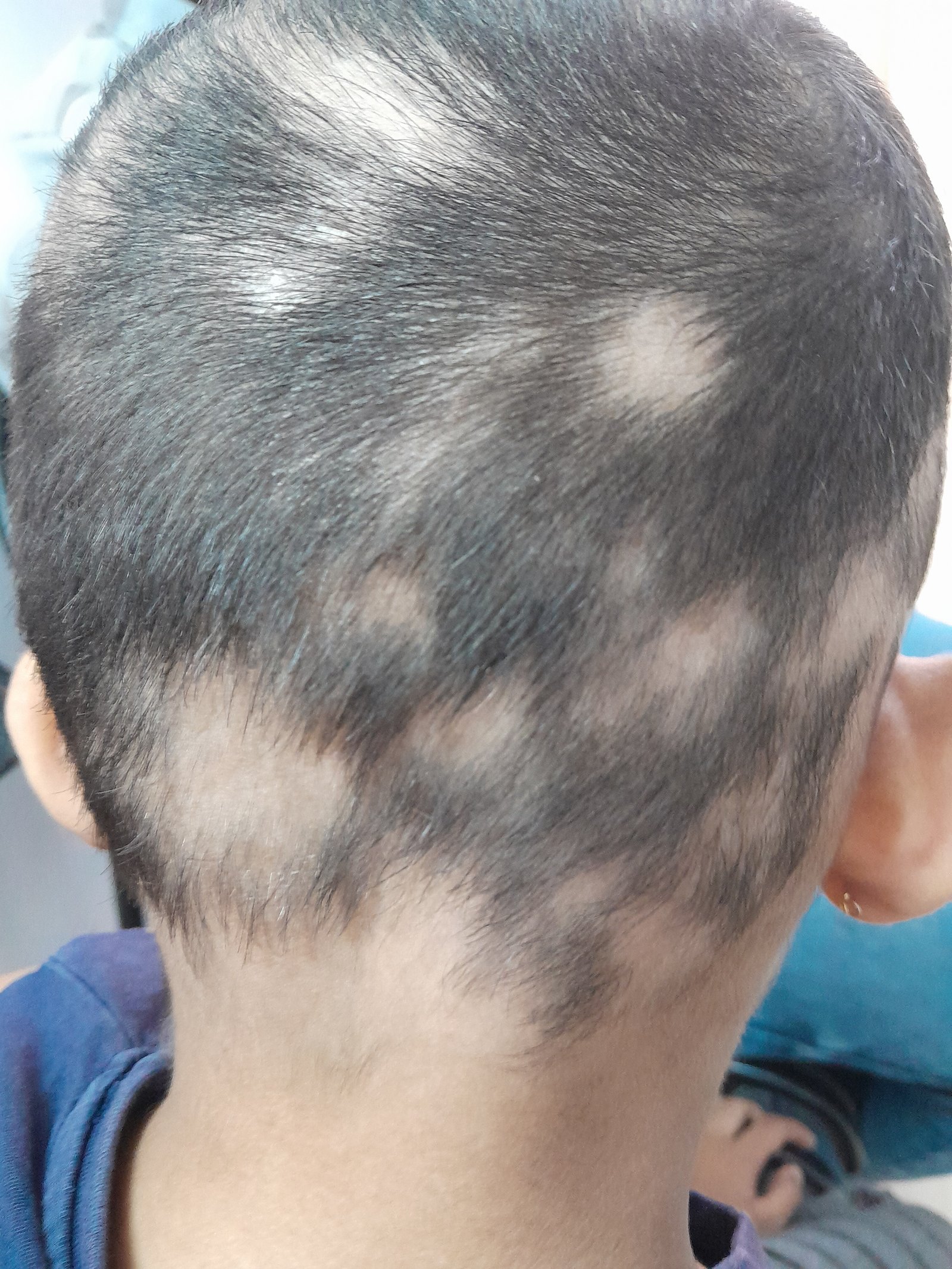 Before Image