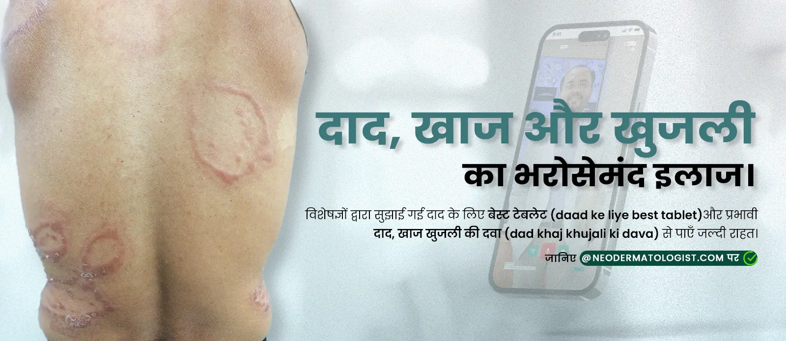 दाद के लिए बेस्ट टेबलेट (daad ke liye best tablet)और प्रभावी दाद खाज खुजली की दवा (dad khaj khujali ki dava)  - दाद, खाज और खुजली का भरोसेमंद इलाज
