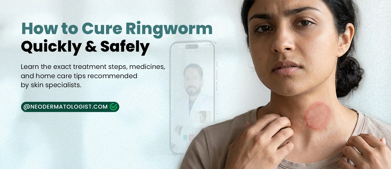 Know how to cure ringworm quickly and easily - dermatologist guide and treatment at Neodermatologist