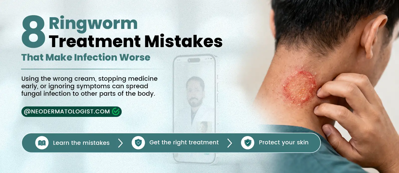 Why your ringworm is not healing - 8 common treatment mistakes explained. Get expert treatment and stop ringworm from spreading