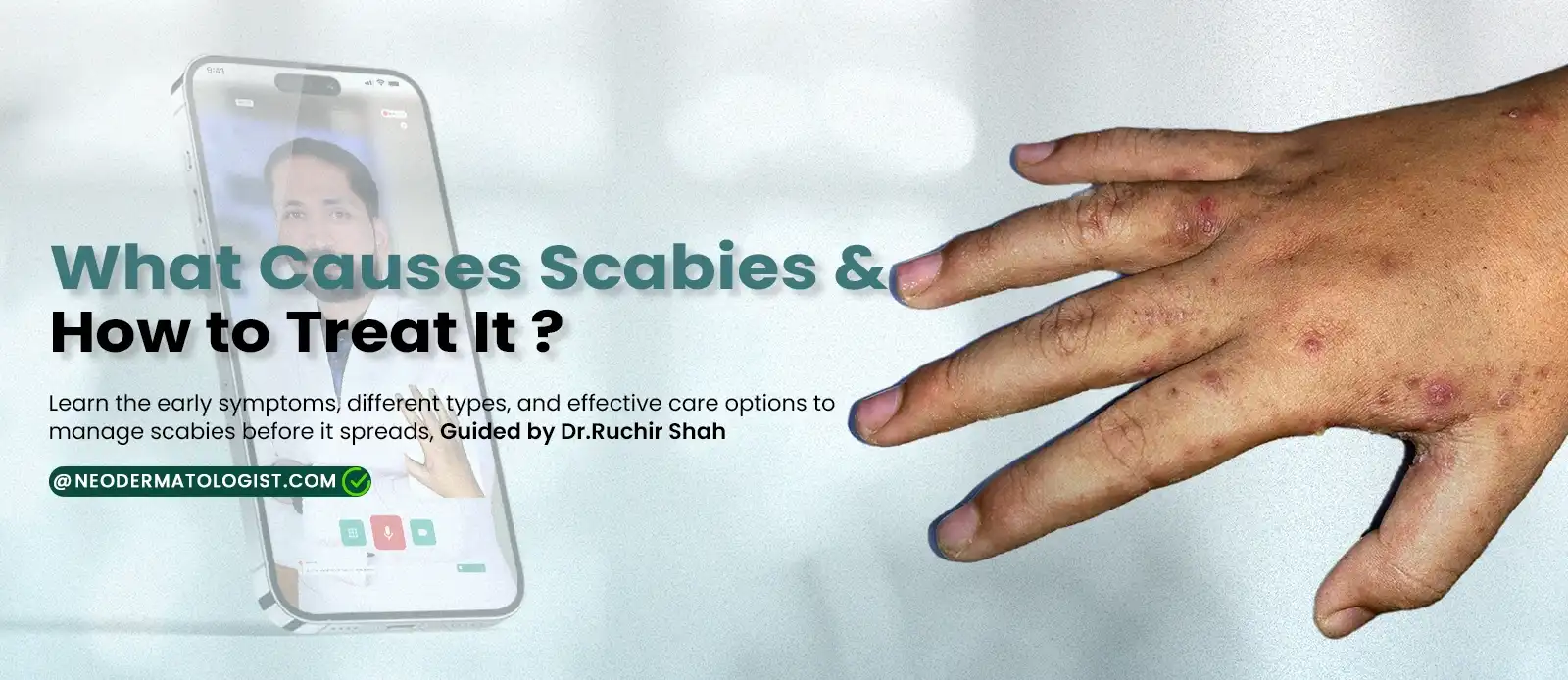 खुजली (स्केबीज़) के कारण क्या हैं और इसका इलाज कैसे करें - स्केबीज़ उपचार के लिए ऑनलाइन त्वचा विशेषज्ञ परामर्श