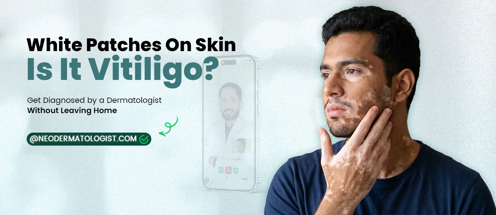 White Patches on Skin - Causes, Types & When to See a Dermatologist
