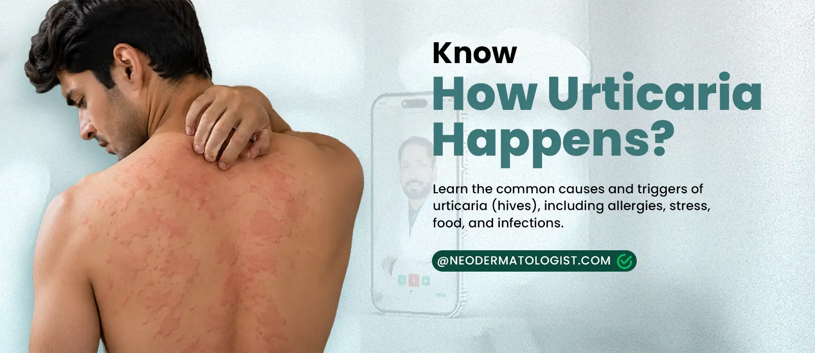 Urticaroial Rash Urticarial Rash Causes: Why Urticaria Happen & Treatment