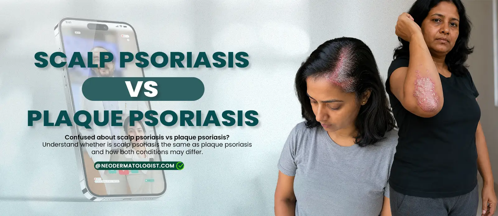 Scalp psoriasis vs plaque psoriasis: Learn the difference in symptoms and affected areas with expert dermatologist guidance at NeoDermatologist