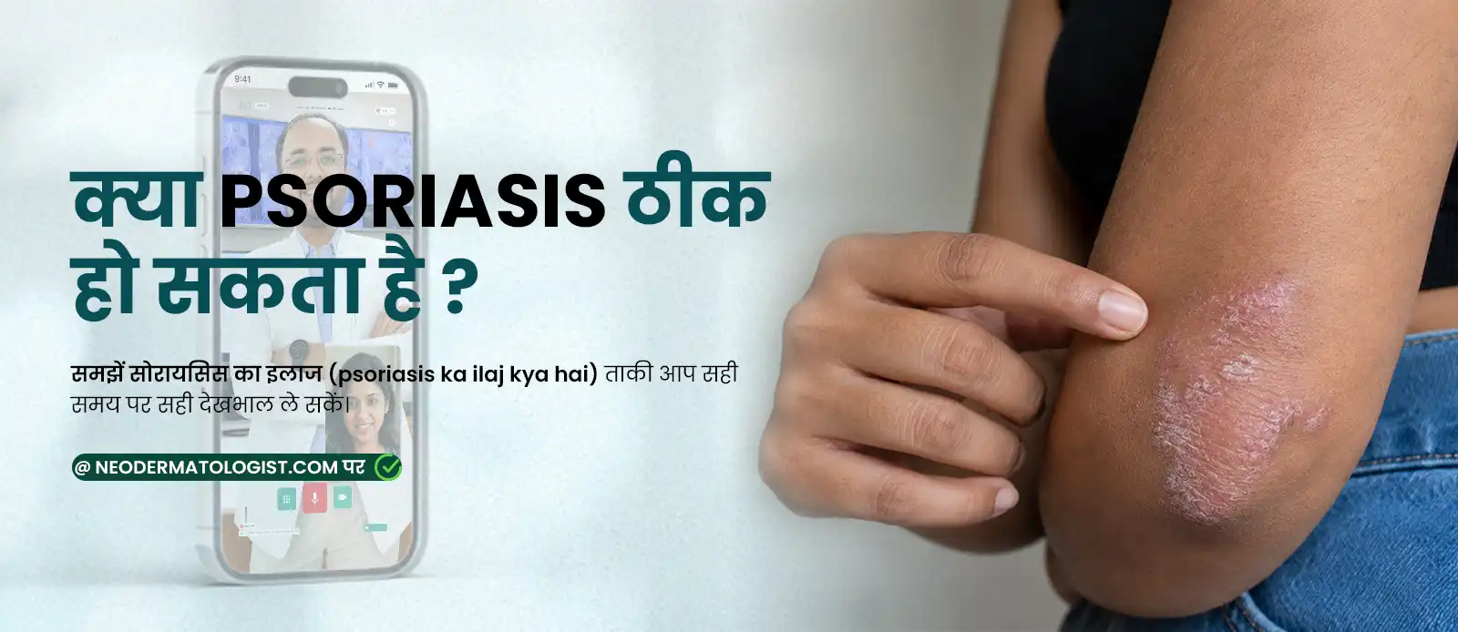 Can psoriasis be cured? Find out what the treatment for psoriasis is and how it can be managed in the long term.