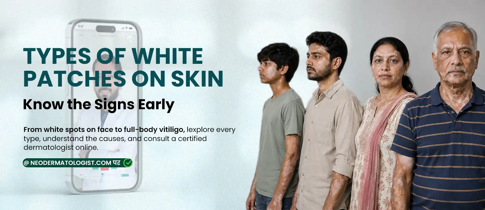 White patches on skin – learn about common types and early signs of vitiligo, and Online consult an expert dermatologist - at NeoDermatologist