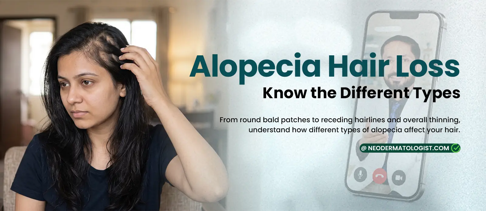 Alopecia Hair Loss: Know the Different Types - Check out when Is important to consult dermatologist online