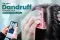  Dandruff Treatment, dandruff treatment for hair - Get Online Dermatology Consultation 
