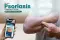 psoriasis treatment or psoriasis skin disease treatment