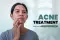 How to treat pimples permanently ( पिंपल कैसे ठीक करें ) - Get pimple treatment by dermatologist