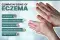 Eczema  symptoms and eczema rash on forearm and hands showing red inflamed patches