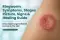 ringworm symptoms ,  ringworm on skin ,   jock itch rash , ringworm stages , ringworm disease , ringworm symptoms in humans , ringworm disease symptoms , fungal infection evolves in skin