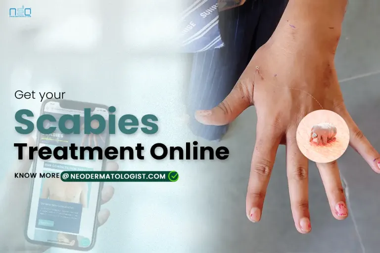 scabies in hindi , scabies kaise hota hai , स्केबीज़ के कारण और इसका उपचार