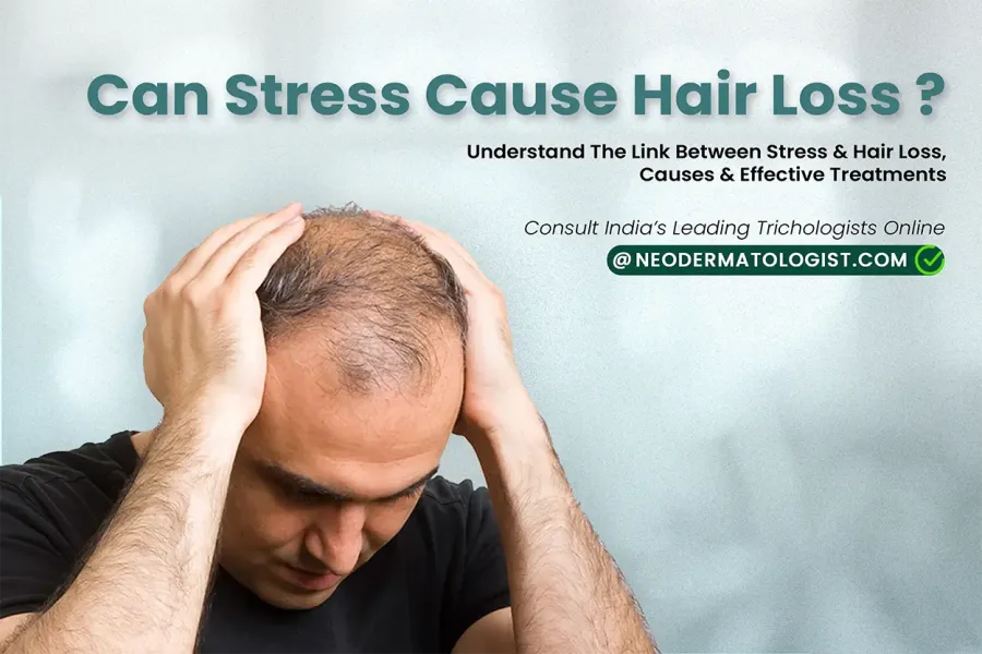 क्या टेंशन से बाल झड़ते हैं, tension se baal jhadte hain kya - जानें बालों का झड़ना और तनाव का संबंध, इलाज और सलाह