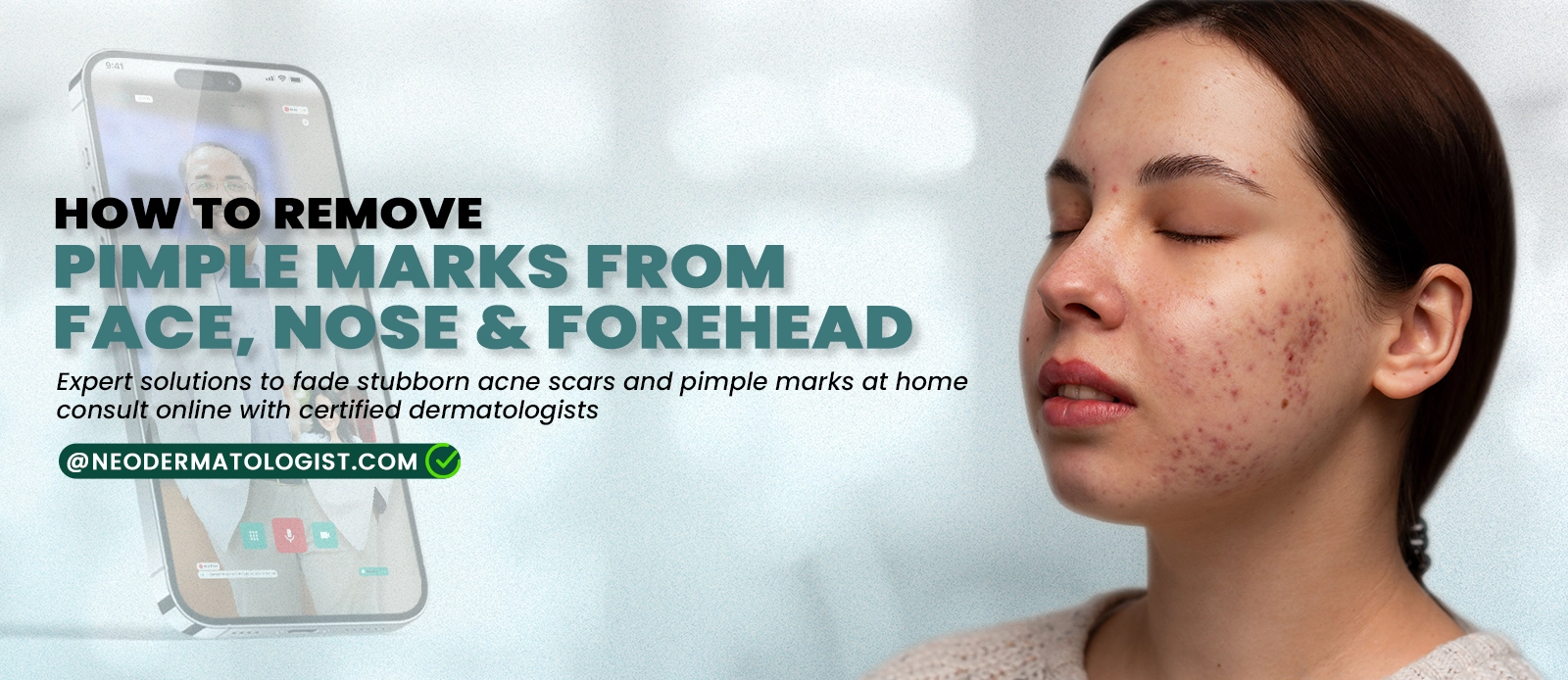 How to Remove Pimple Marks from Face, Nose & Forehead - Get expert treatment online by dermatologist