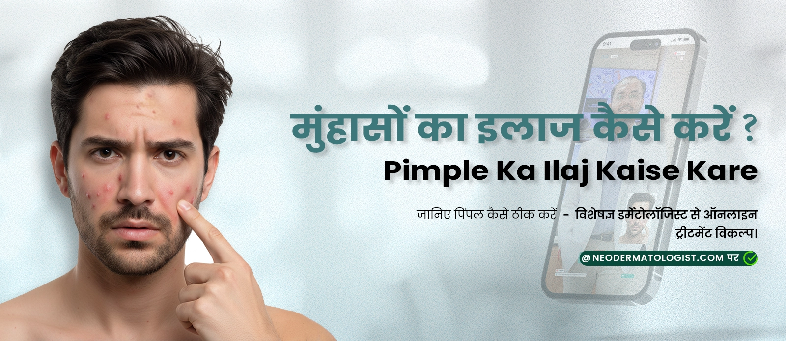 मुंहासों का इलाज कैसे करें ( Pimple Ka Ilaj Kaise Kare ) -  जानिए पिंपल कैसे ठीक करें - विशेषज्ञ डर्मेटोलॉजिस्ट से ऑनलाइन ट्रीटमेंट विकल्प
