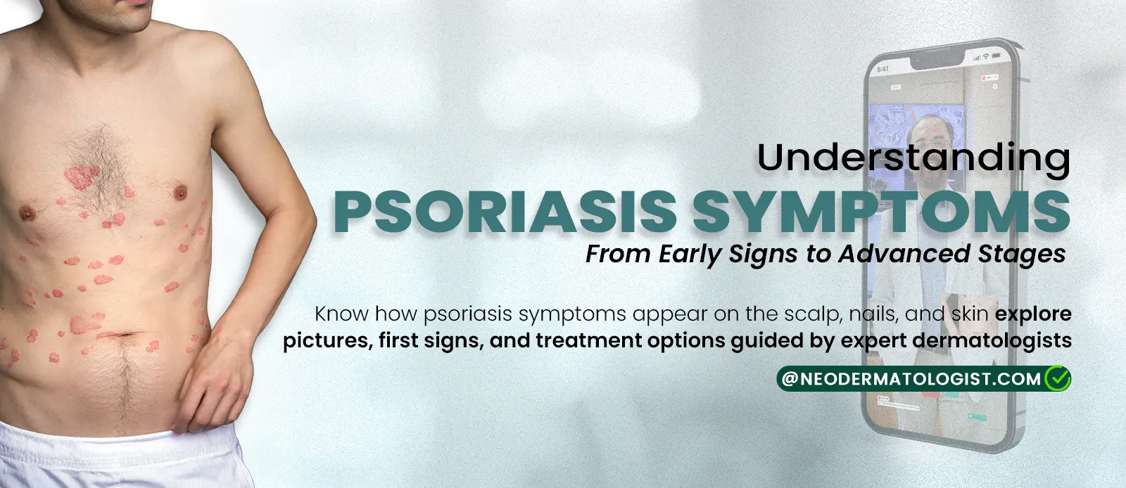 Understanding Psoriasis Symptoms: From Early Signs to Advanced Stages -  By a Neodermatologist
