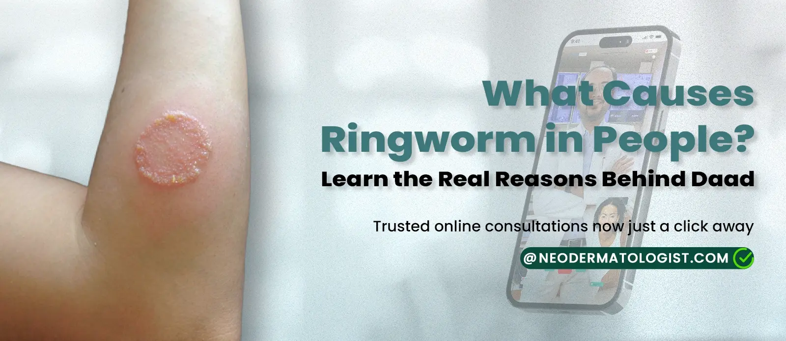 लोगों में दाद क्यों होता है? दाद के पीछे के असली कारण जानें – भरोसेमंद ऑनलाइन त्वचा विशेषज्ञ परामर्श अब बस एक क्लिक दूर