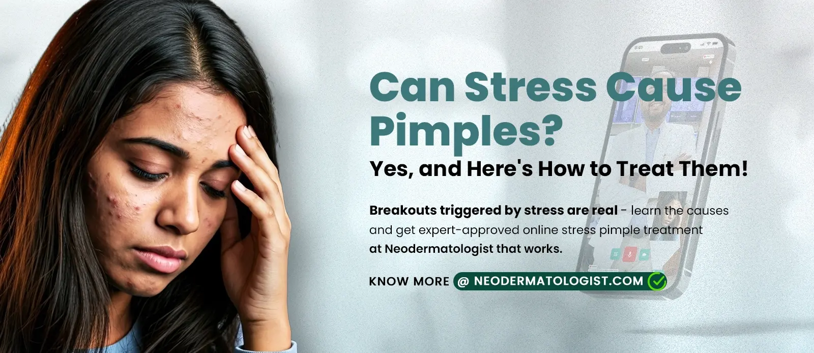 Can Stress Cause Pimples? - Know & learn the causes and get expert-approved online stress pimple treatment at Neodermatologist that works.