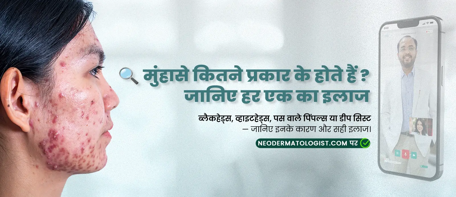 मुंहासे कितने प्रकार के होते हैं - ब्लैकहेड्स, व्हाइटहेड्स, पस वाले पिंपल्स या डीप सिस्ट  - जानिए हर एक का इलाज मुंहासे विशेषज्ञ के साथ Neodermatologist