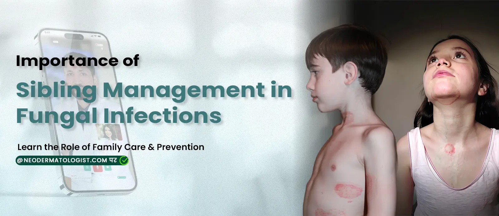 फंगल इन्फेक्शन में भाई-बहन की देखभाल का महत्व - फंगल इन्फेक्शन को समझें और दाद कैसे फैलता है, जानें नियोडर्मेटोलॉजिस्ट से