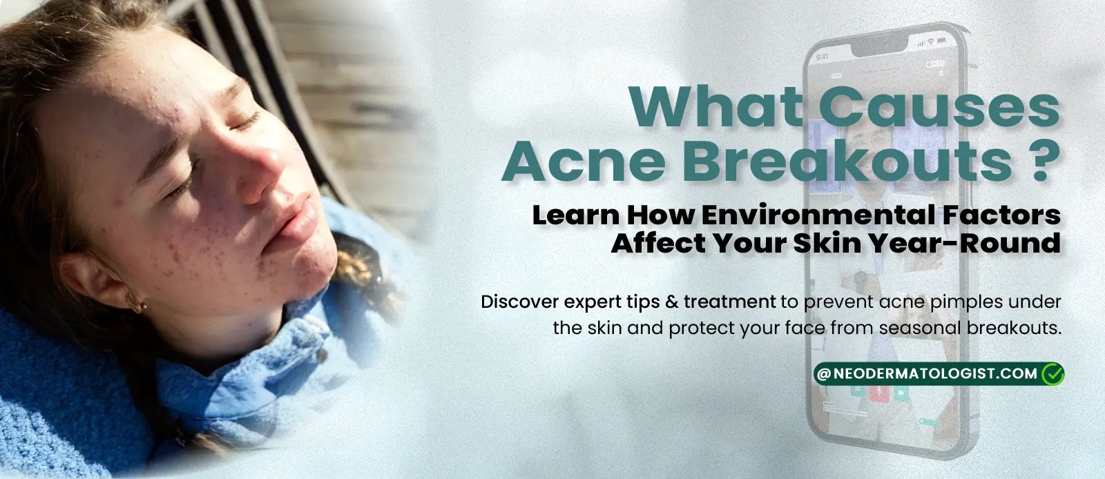 मुंहासे क्यों होते हैं? जानें पर्यावरणीय कारक आपकी त्वचा को कैसे प्रभावित करते हैं - NeoDermatologist पर ऑनलाइन पिंपल ट्रीटमेंट प्राप्त करें