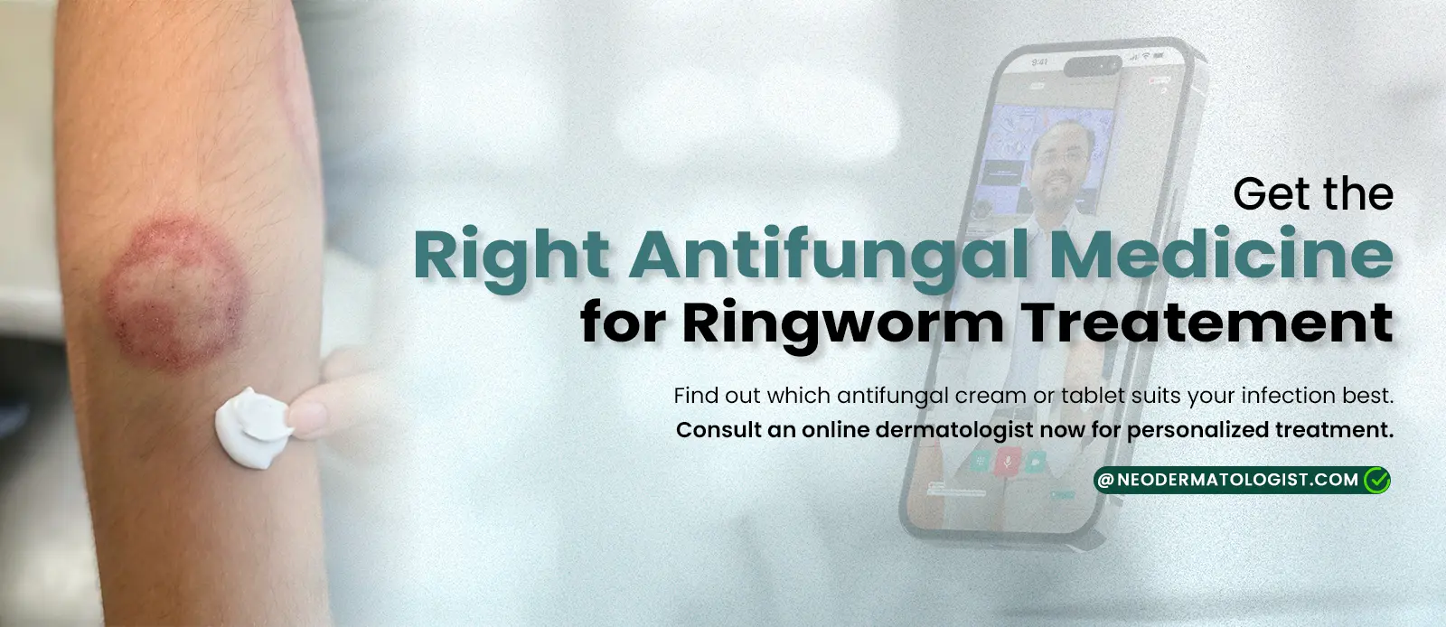 Right Antifungal Medicine for Ringworm Treatment - Consult Ringworm Dermatologist Online At Neodermatologist
