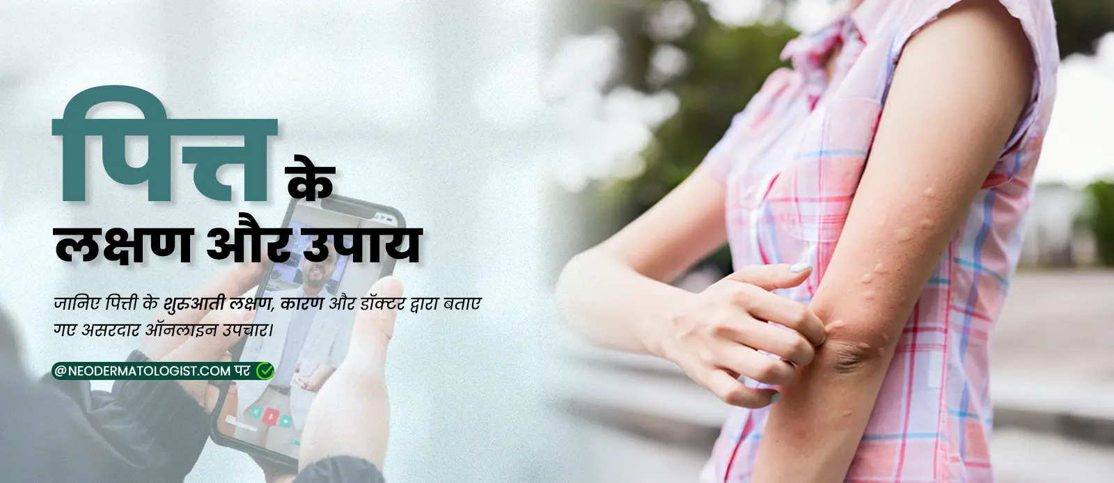 hives (urticaria) - Causes, symptoms, types, and solutions at Neodermatologist
