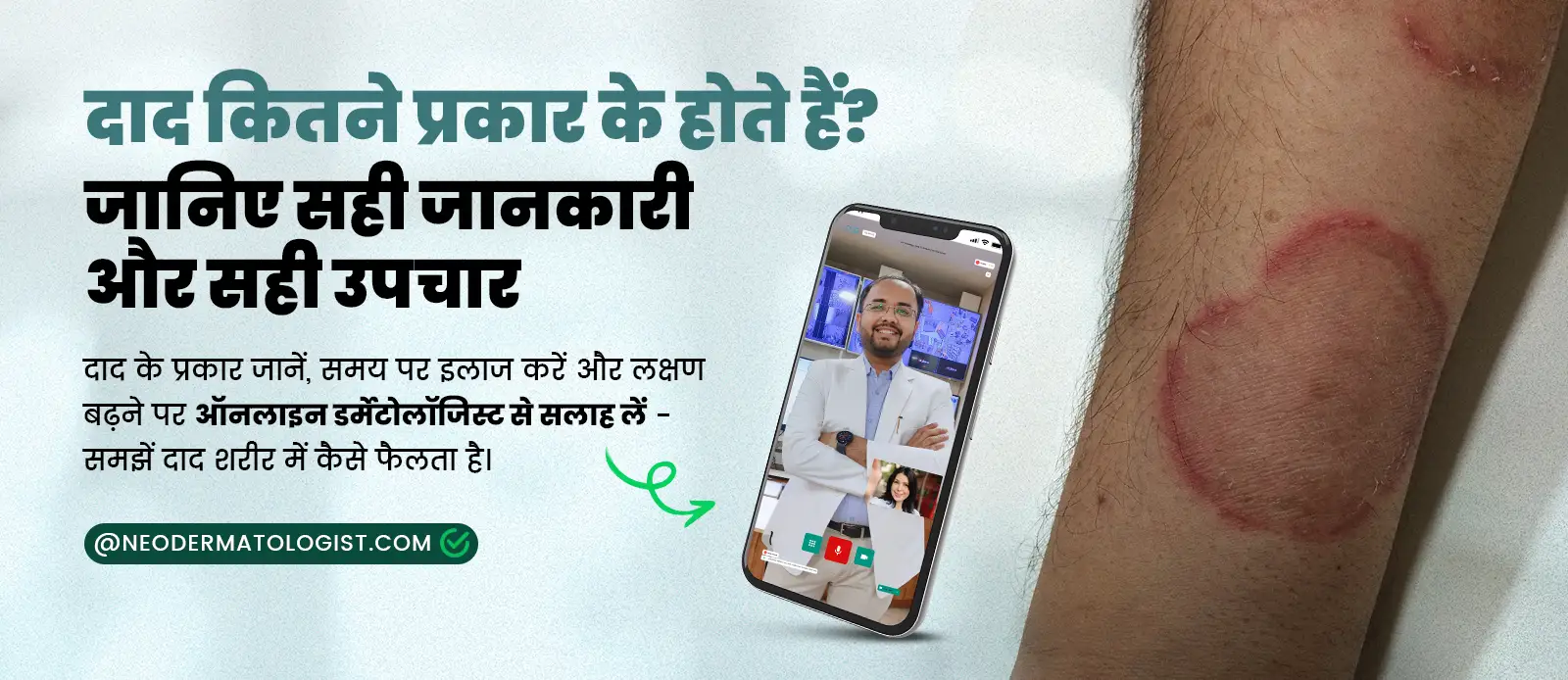 ( दाद कितने प्रकार के होते हैं? ) Daad ke kitne prakar hote he - जानिए सही जानकारी और सही उपचार | ऑनलाइन डर्मेटोलॉजिस्ट से सलाह लें - समझें दाद शरीर में कैसे फैलता है।