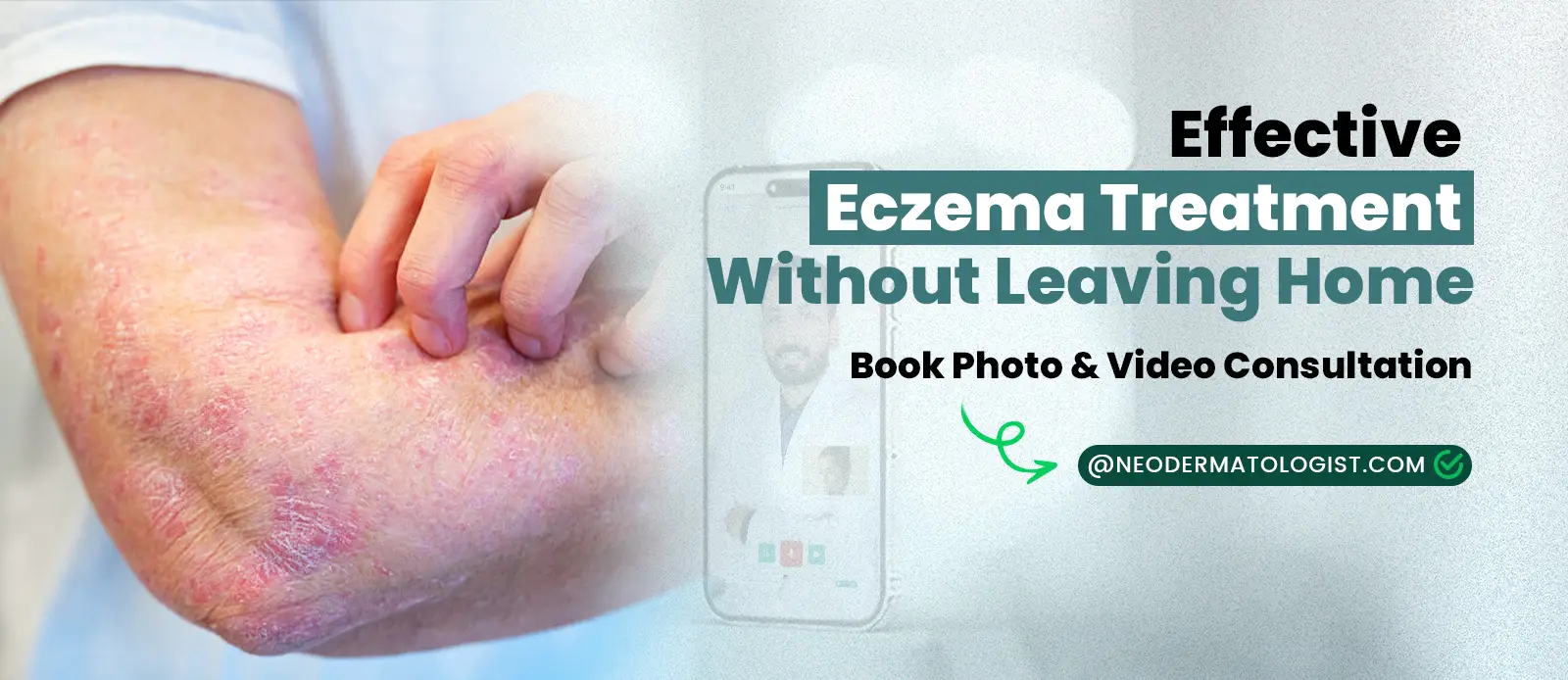 Effective Eczema Treatment Without Leaving Home - Consult a Dermatologist Online