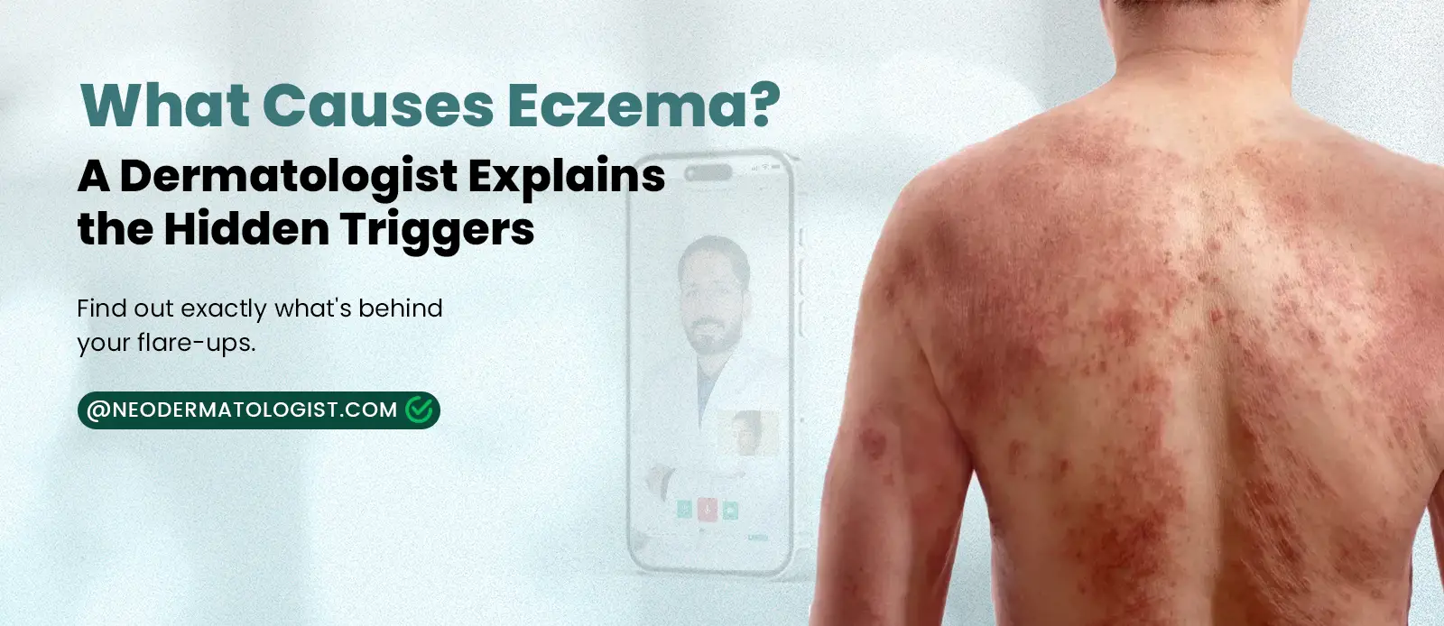 What Causes Eczema? A Dermatologist Explains the Hidden Triggers of Eczema by a Certified Dermatologist At Neodermatologist