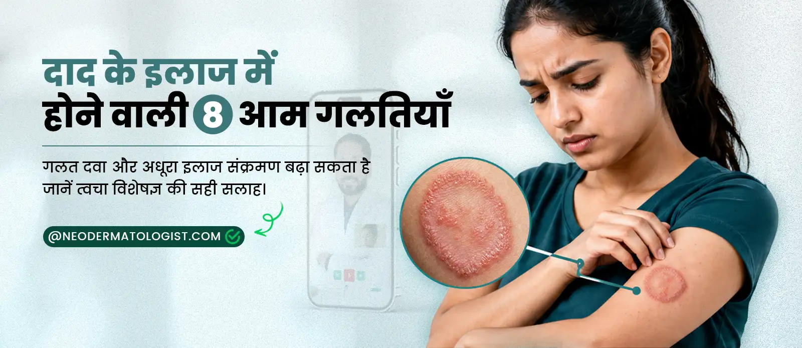 दाद के इलाज की आम 8 गलतियाँ जिससे फंगल संक्रमण फैलता है