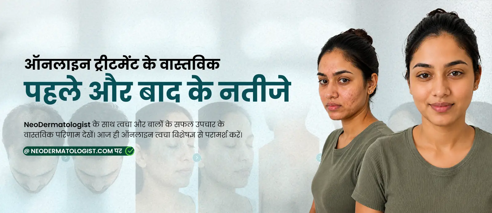 ऑनलाइन ट्रीटमेंट के वास्तविक 'पहले और बाद' के नतीजे - NeoDermatologist पर आज ही ऑनलाइन त्वचा विशेषज्ञ से परामर्श करें