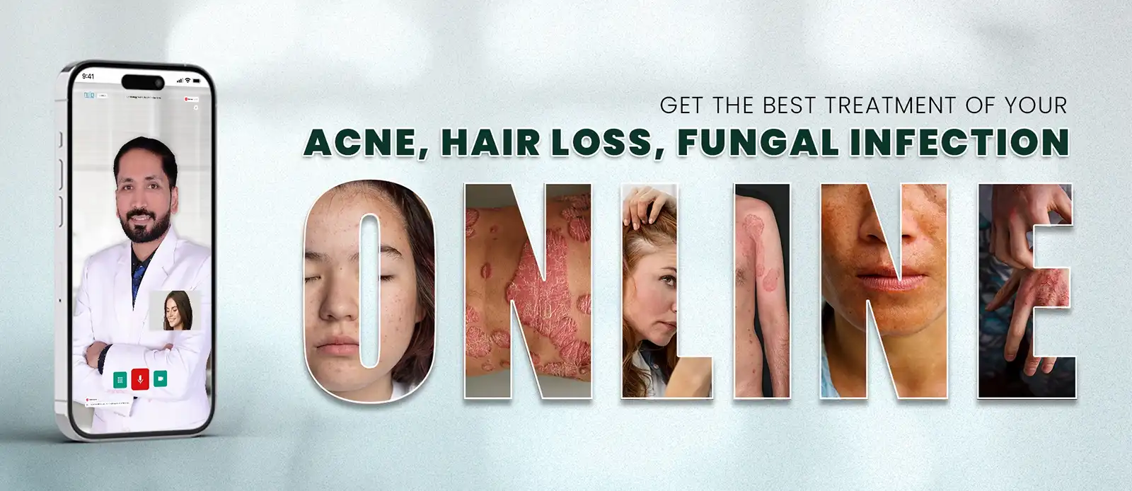 Get online dermatologist consultation treatment for acne, general skin consultation, scabies, urticaria hives, eczema, vitiligo, ringworm, and many more