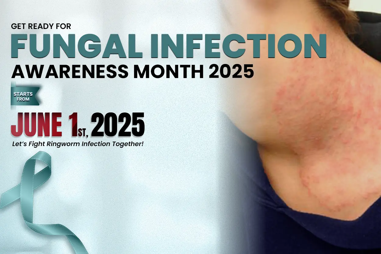 fungal infection awareness month 2025, ringworm infection awareness month 2025 , फंगल इन्फेक्शन  अवेयरनेस मंथ 2025, दाद इन्फेक्शन अवेयरनेस मंथ 2025, 