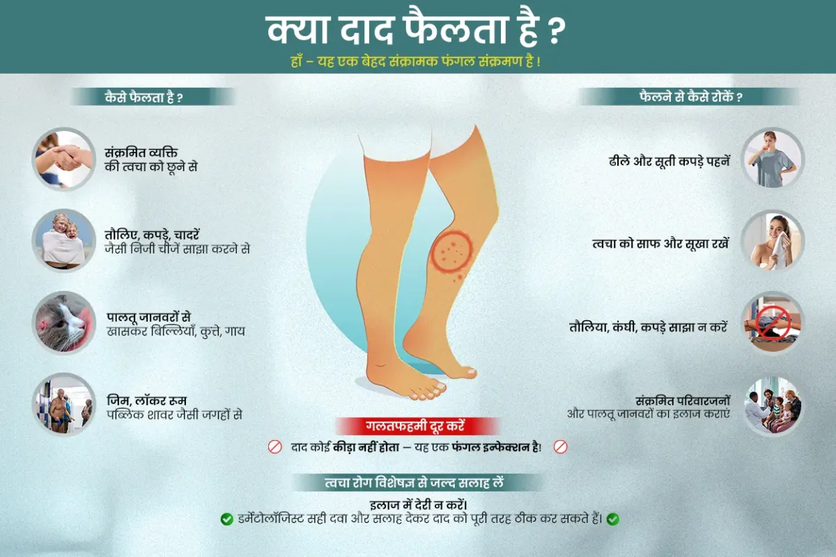 Is ringworm spreadable? is ringworm contagious? , How Ringworm Spreads