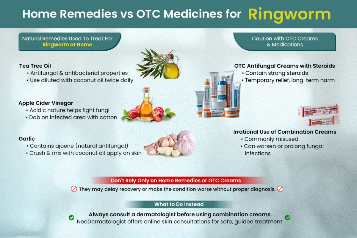 Home Remedies vs OTC Medicines for Ringworm - consult a dermatologist before using HOME REMEDIES OR OTC MEDICINES