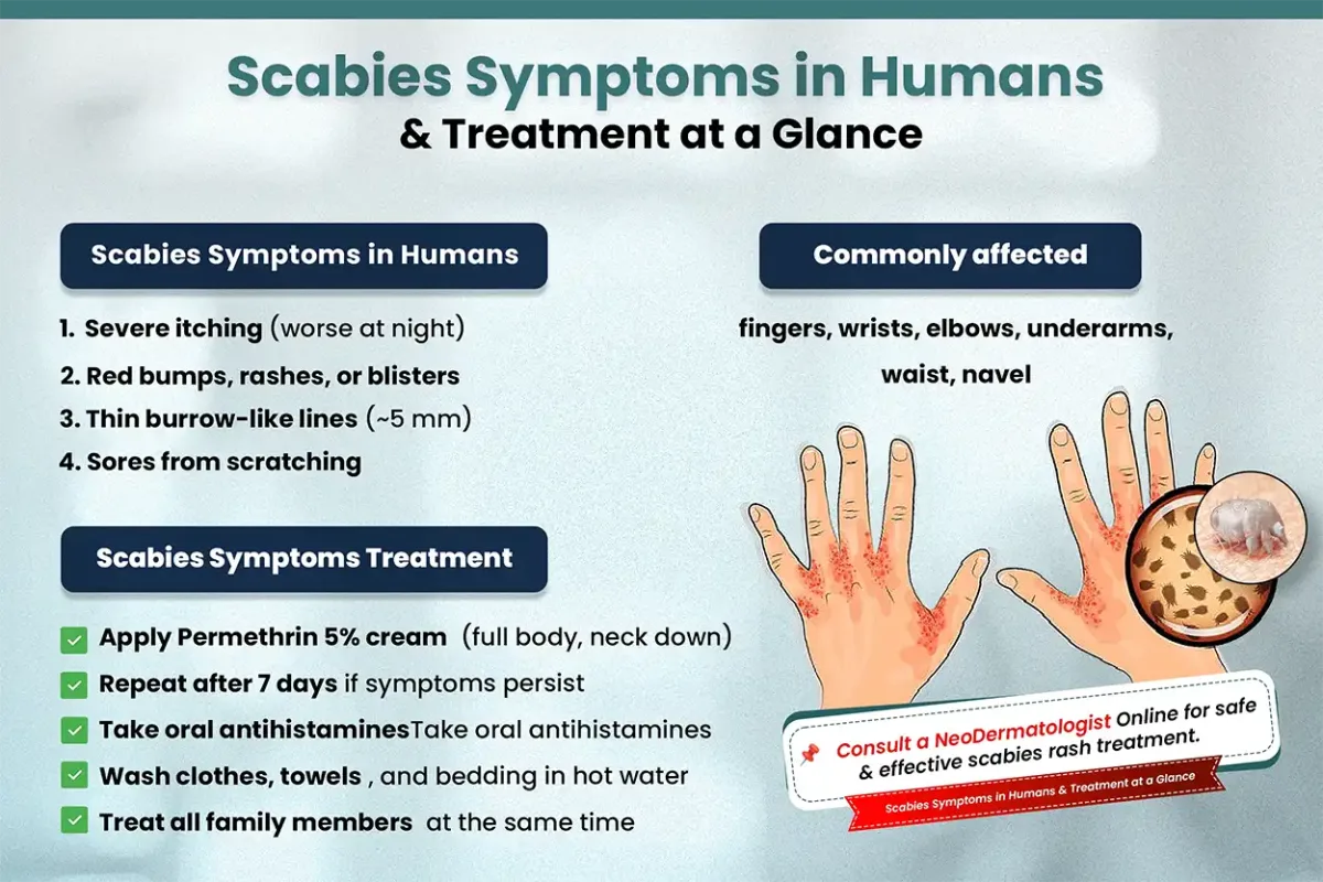 Scabies Symptoms in Humans & Treatment at a Glance