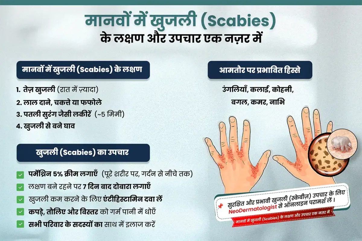  मानवों में खुजली (Scabies) के लक्षण और उपचार एक नज़र में