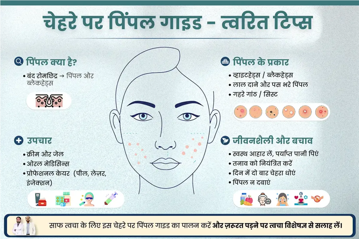 चेहरे पर पिंपल गाइड - त्वरित टिप्स - पिंपल्स विशेषज्ञ डॉ. रुचिर शाह डॉक्टर से पेशेवर मार्गदर्शन ले