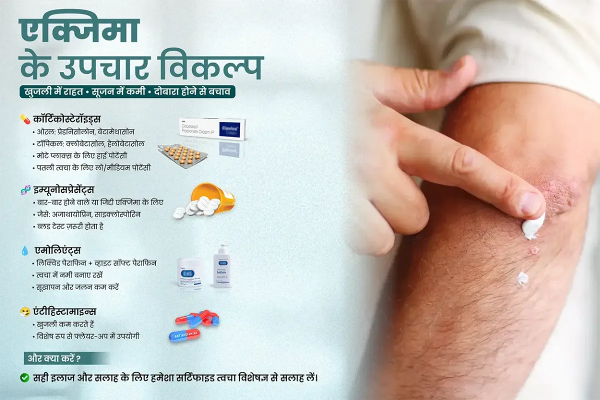 एक्जिमा के उपचार विकल्प - सही इलाज और सलाह के लिए हमेशा सर्टिफाइड त्वचा विशेषज्ञ से सलाह लें।