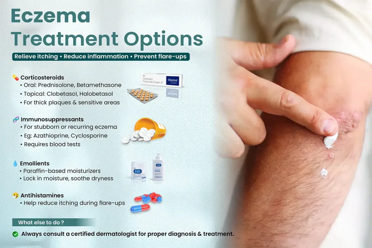 Eczema Treatment Option from Corticosteroids to many more -  Consult a certified dermatologist for proper diagnosis & treatment 