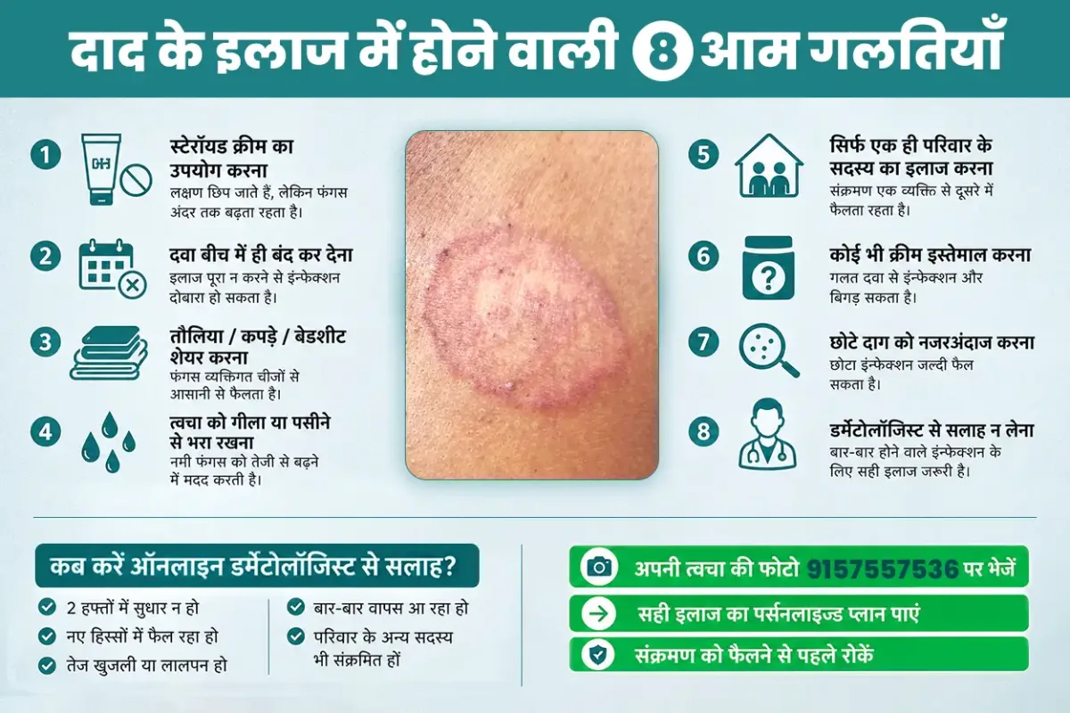 दाद के इलाज में होने वाली 8 आम गलतियाँ जो संक्रमण को और भी बदतर बना सकती हैं - त्वचा विशेषज्ञ की सलाह और दाद का उपचार