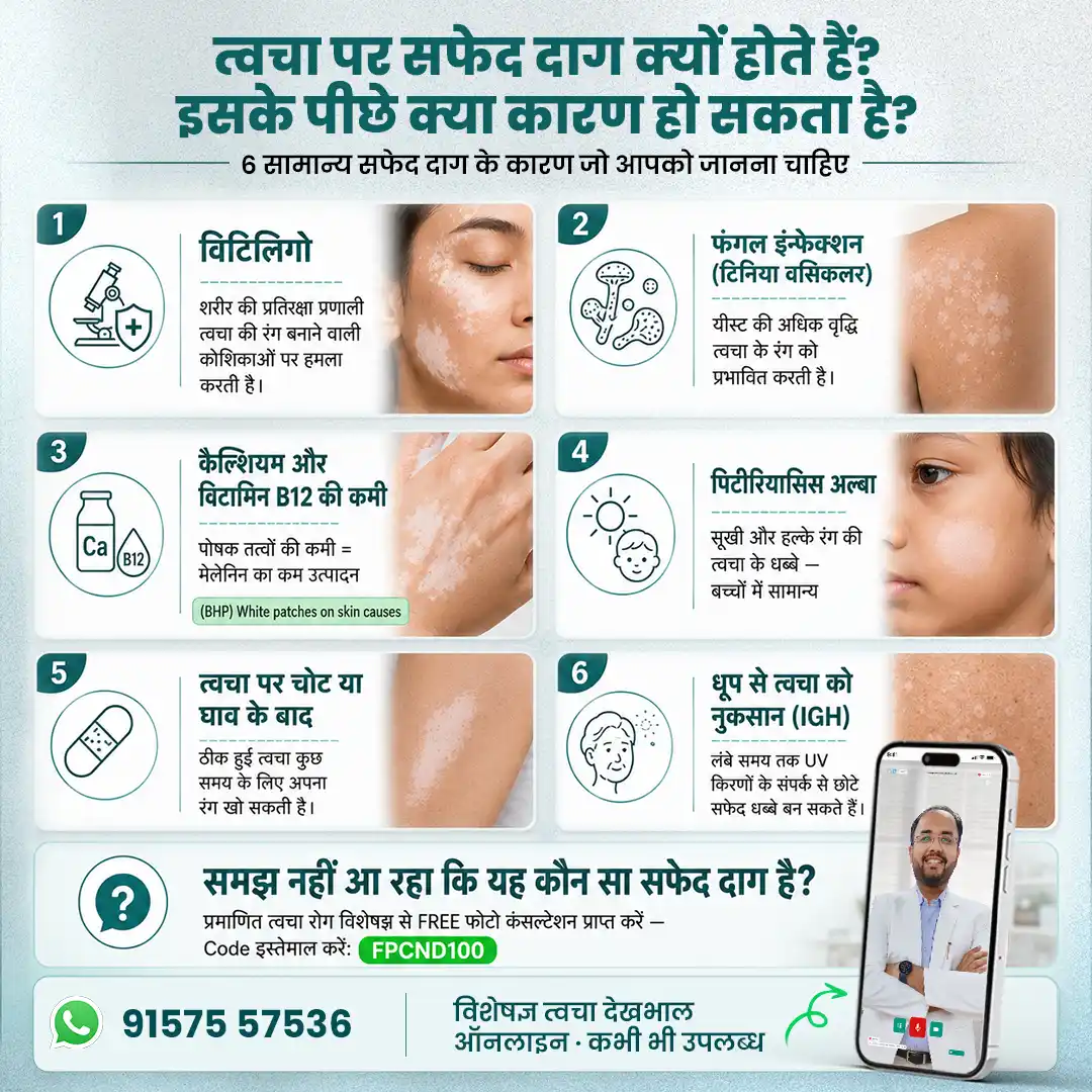 जाने त्वचा पर सफेद दाग क्यों होते हैं? - इसके पीछे क्या कारण हो सकता है?