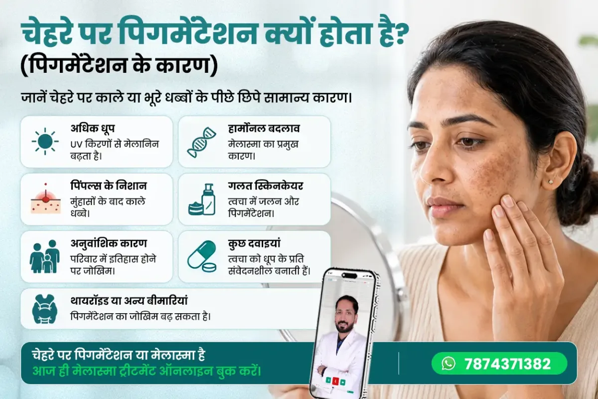 चेहरे पर पिगमेंटेशन के कारण दिखाने वाला इन्फोग्राफिक जिसमें धूप, हार्मोनल बदलाव, मुंहासों के निशान, गलत स्किनकेयर, अनुवांशिक कारण, दवाइयों का प्रभाव और थायरॉइड समस्याएं बताई गई हैं। चेहरे के पिगमेंटेशन के कारण जानें और ऑनलाइन मेलास्मा ट्रीटमेंट प्राप्त करें।