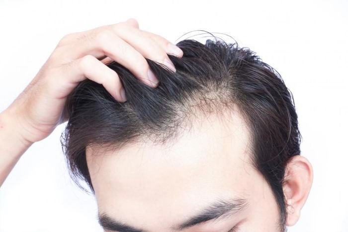 Hair loss